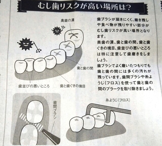 むし歯リスクが高い場所は?.jpg