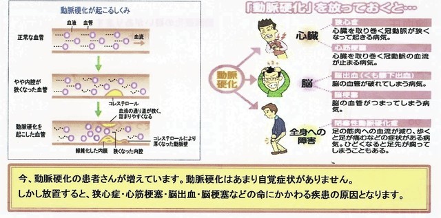 動脈硬化検査3.jpg