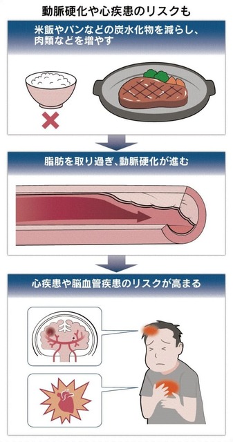 糖質制限のワナ.jpg